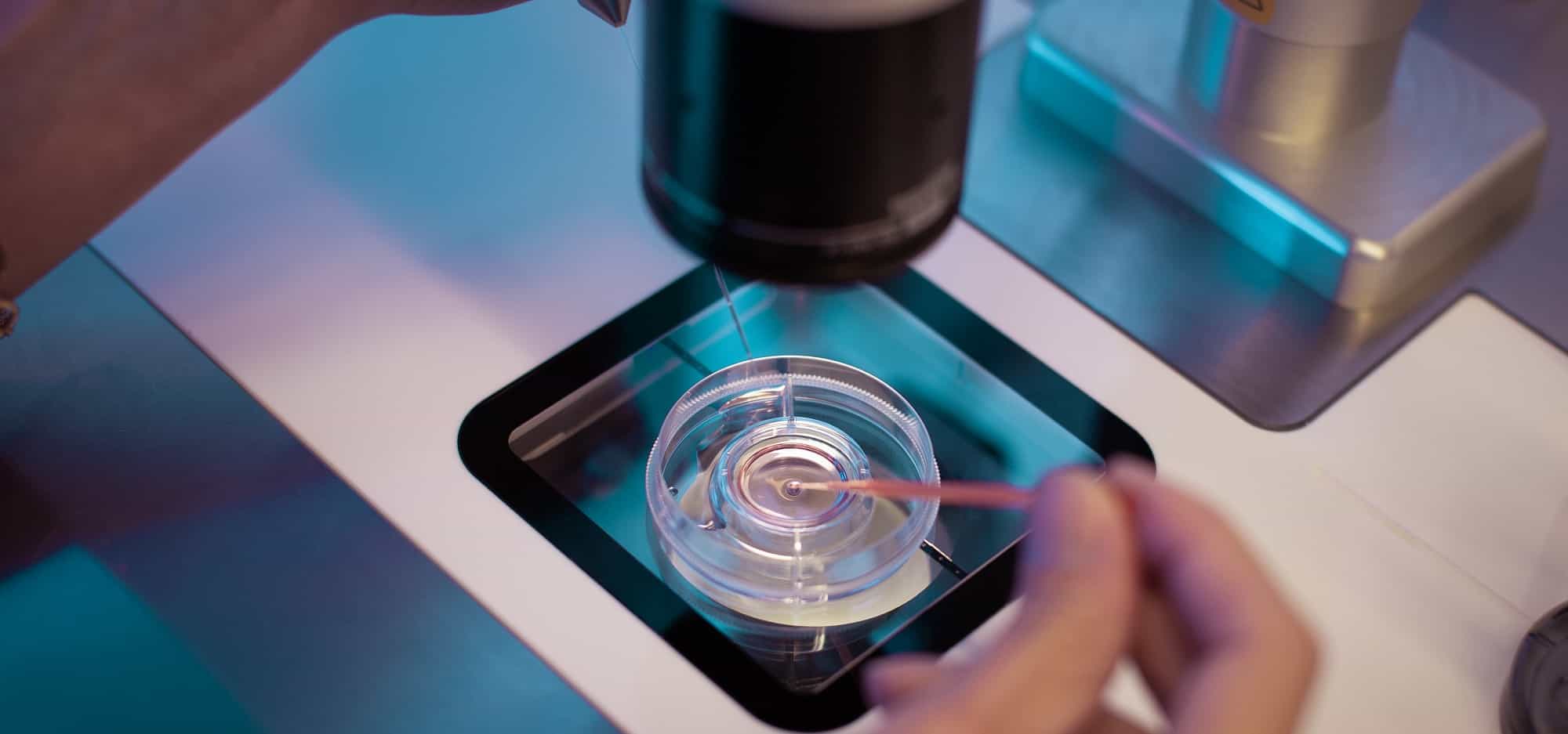 IVF Treatment | Infertility Treatments in Dubai