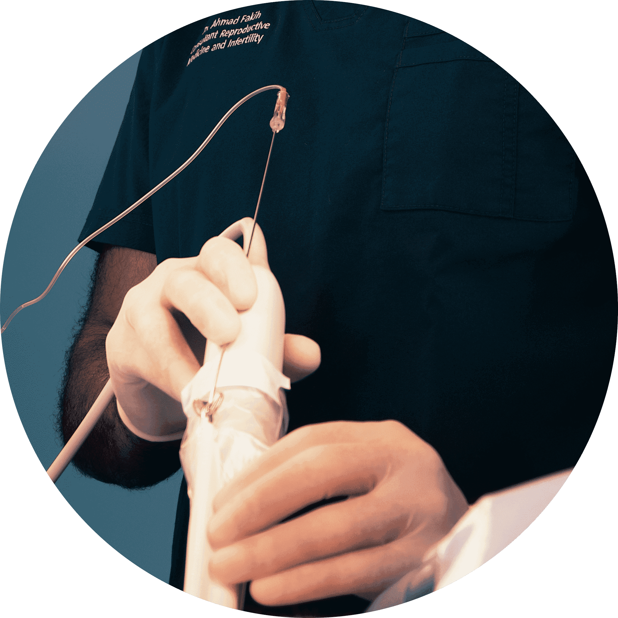 Ovarian stimulation | Mini IVF